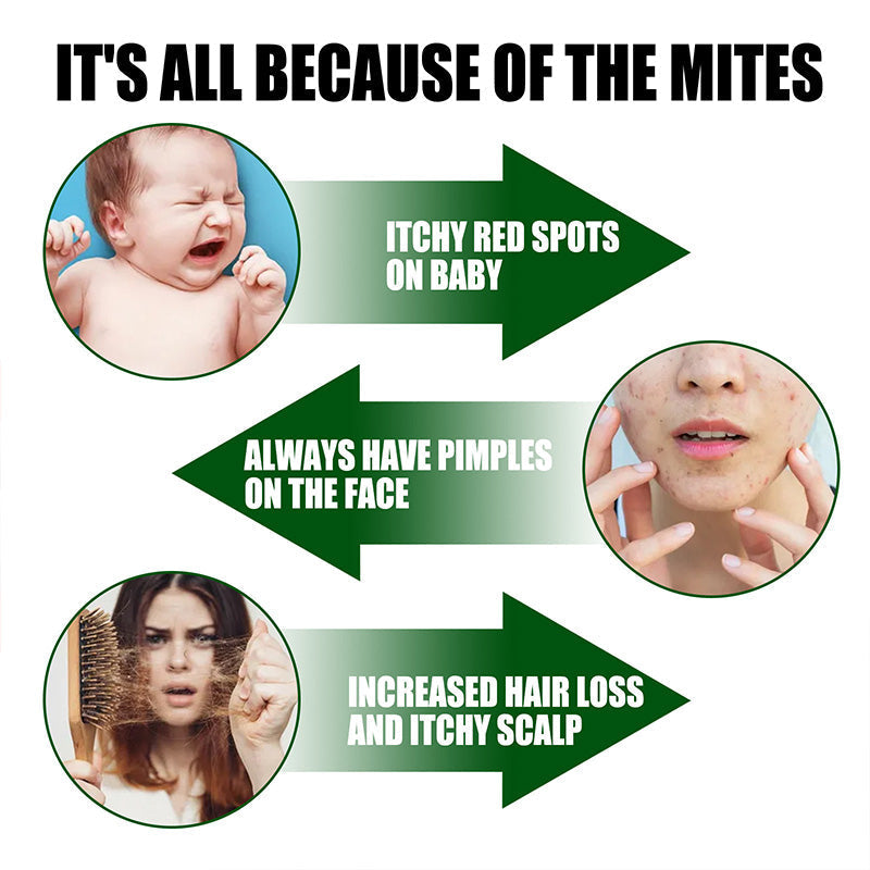 ⚡Περιορισμένη Προσφορά, Αγοράστε 2, Πάρτε 1 Δωρεάν⚡-🧑‍⚕️Ισχυρό Σπρέι Απομάκρυνσης Ακάρεων-SI