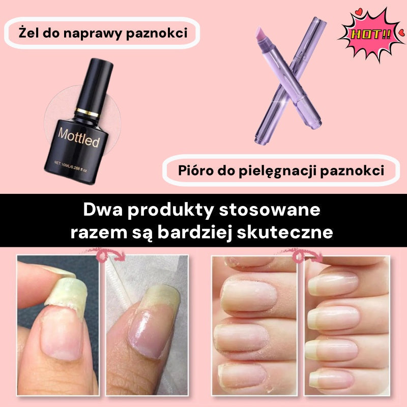 💜Večnamenski, prozoren 3-v-1 gel za obnovo nohtov-SI
