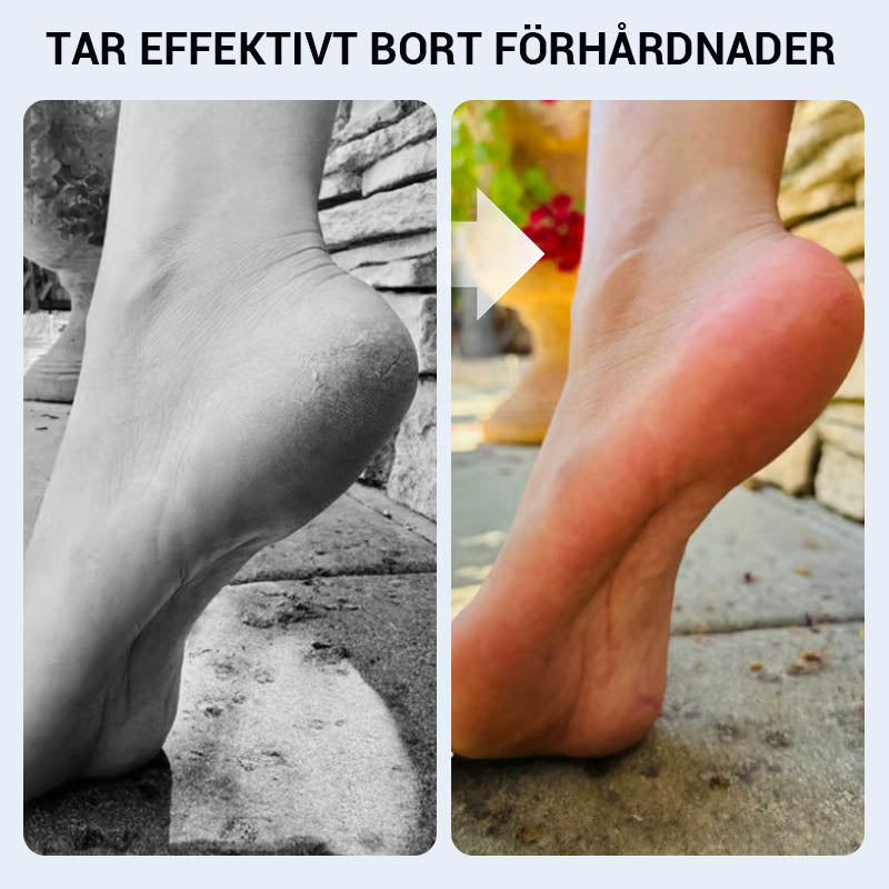 🔥 ﻿Praktiškas rankinis pėdų nuospaudų valiklis🦶🏻-LT