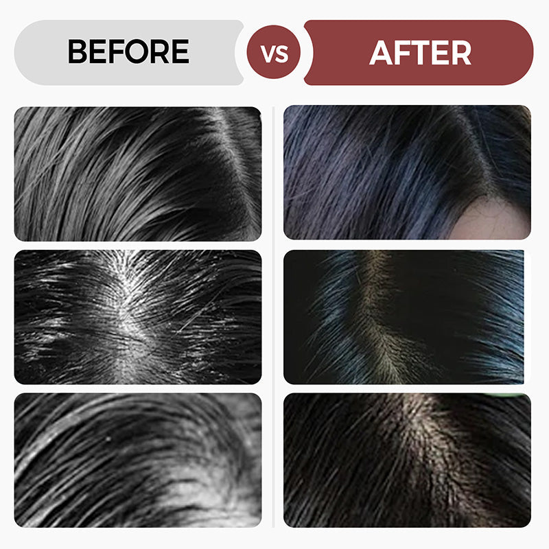 💥Dabar parduodama visame pasaulyje🔥Naujai sukurta giliai drėkinanti plaukų kaukė⏲️Riboto laiko pasiūlymas – pirkite daugiau, gaukite daugiau nemokamai-LT