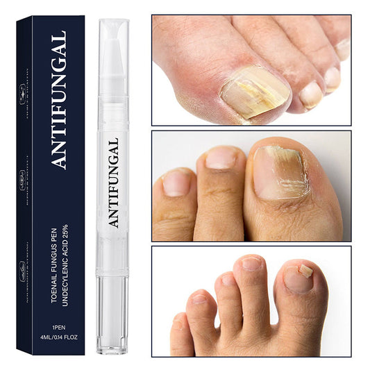 🔥Svinčnik za zdravljenje glivic na nohtih (za poškodovane nohte)-SI